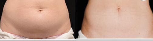 WhatsApp Image 2022-02-23 at 17.45.12